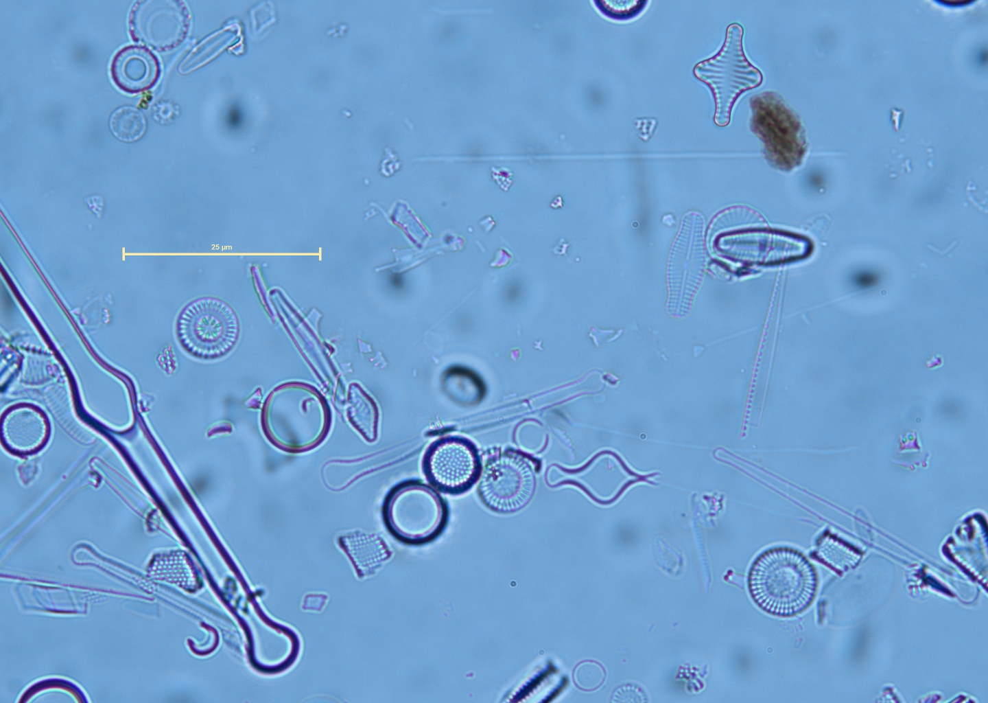 Discostella stelligera