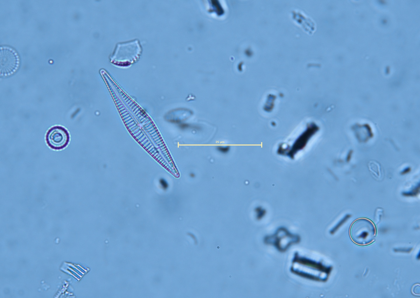 Navicula winonae